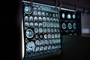 Tele Radiology Reporting at Shree Telerad: Redefining Modern Diagnostic Services