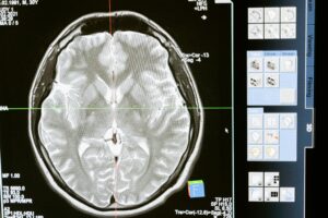 Shree Telerad: Online Radiology Reporting in India